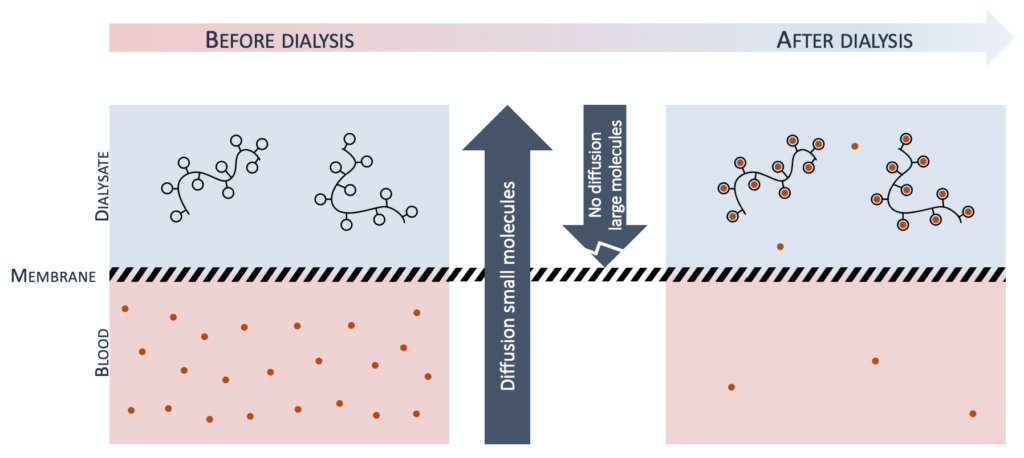 Before-After dialysis